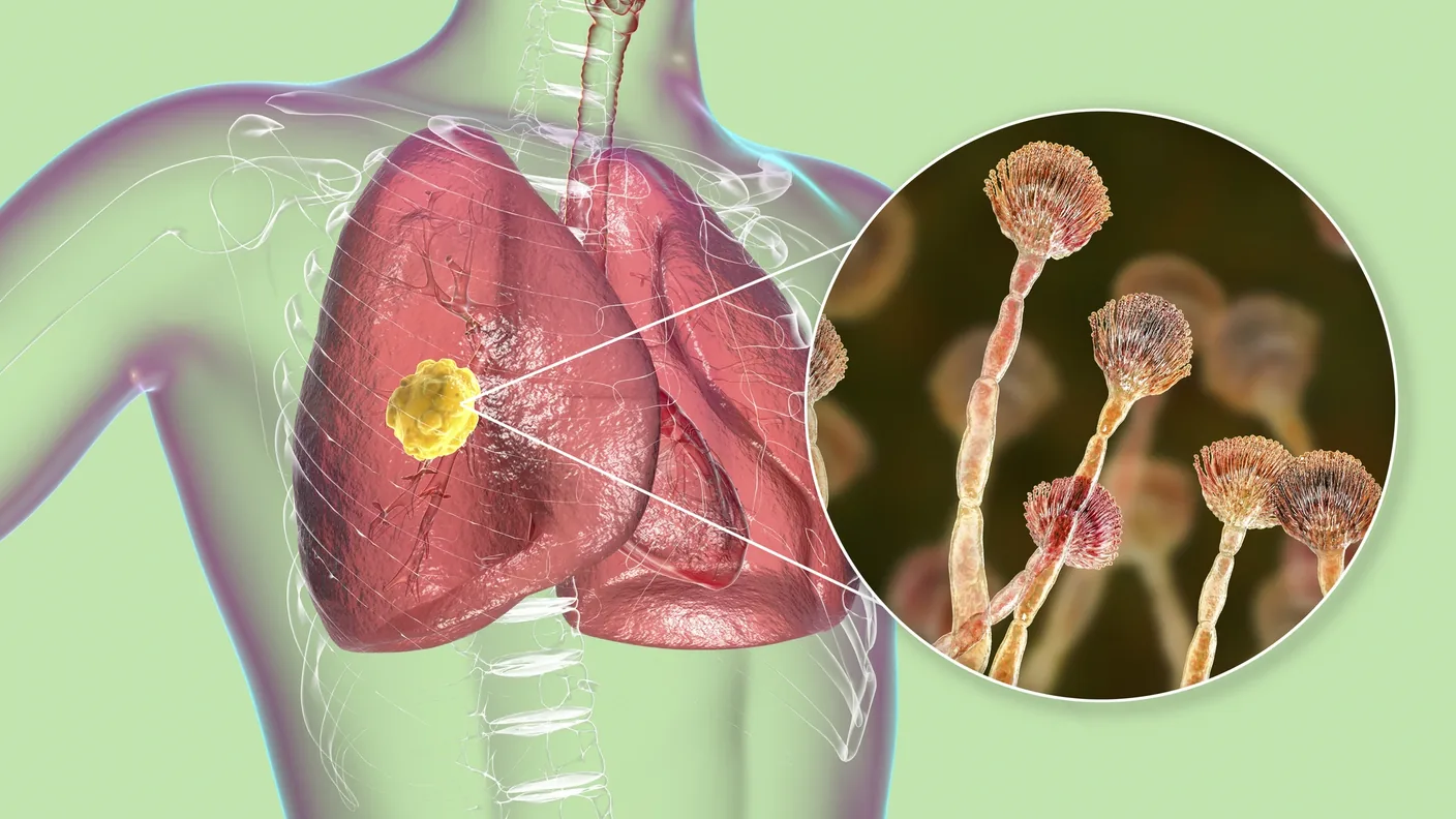 Mikroskopisk vækst af Aspergillus-skimmelsvamp
